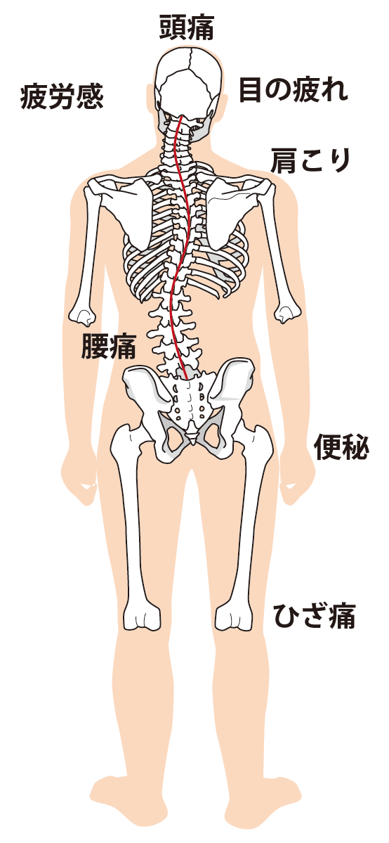 当院の眼精疲労へのアプローチとは