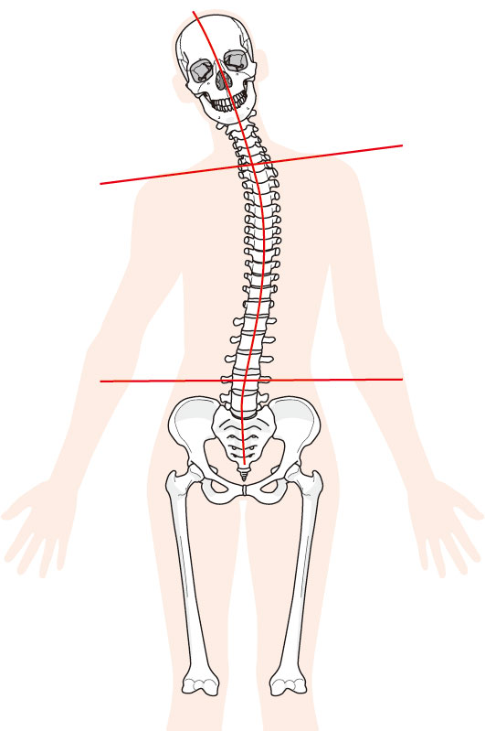 当院の過敏性腸症候群へのアプローチとは