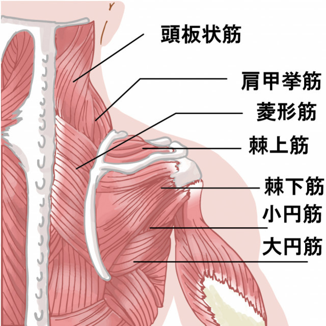 頭痛の原因は体の歪みです。